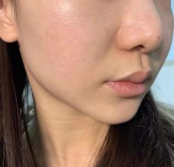 -痣斑堂·取大痣