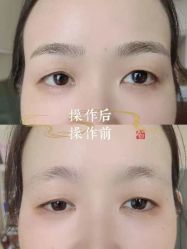 点击看大图 -西施无菌半永久纹绣眉眼影唇轻增发纹发际线