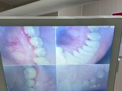 -同步齿科·数字化正畸种植口腔中心(前山店)