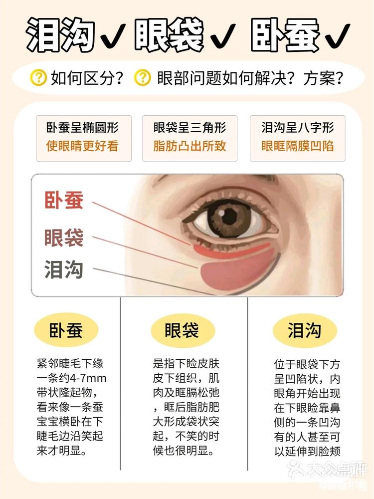 快速了解眼周泪沟卧蚕的区别