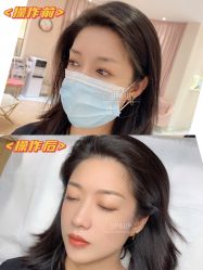 -UP&UP·半永久眉毛眼线机器野生眉