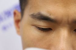 -大麦微针植发丨全国连锁