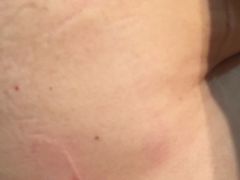 -大韩庄韩氏祖传正骨