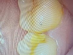 -土豆口腔(凤凰北总店)