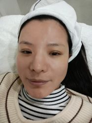 -郡艺医疗美容·微整·眼鼻吸脂