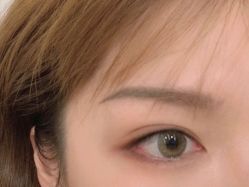 点击看大图 体验后-紫洁俪方(北京)医疗美容