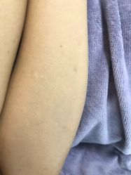 -植蔻妍皮肤管理美肤中心