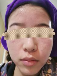 -安徽合肥韩美整形外科医院