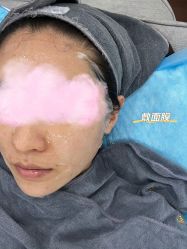 体验后-澳尔颜选医疗美容