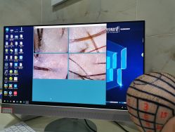 -雍禾植发全国连锁