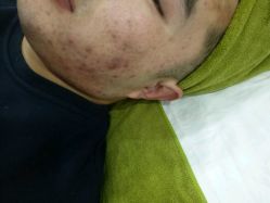 -荟草堂痘肌修护中心