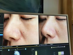 -苑苑vbeauty科技美容SPA