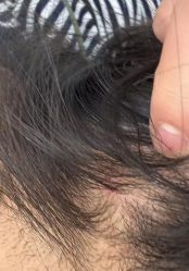 -北京美痣堂古方祛痣斑疣瘊