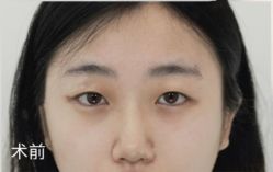 点击看大图 体验前-Dr.U博士医疗美容医院
