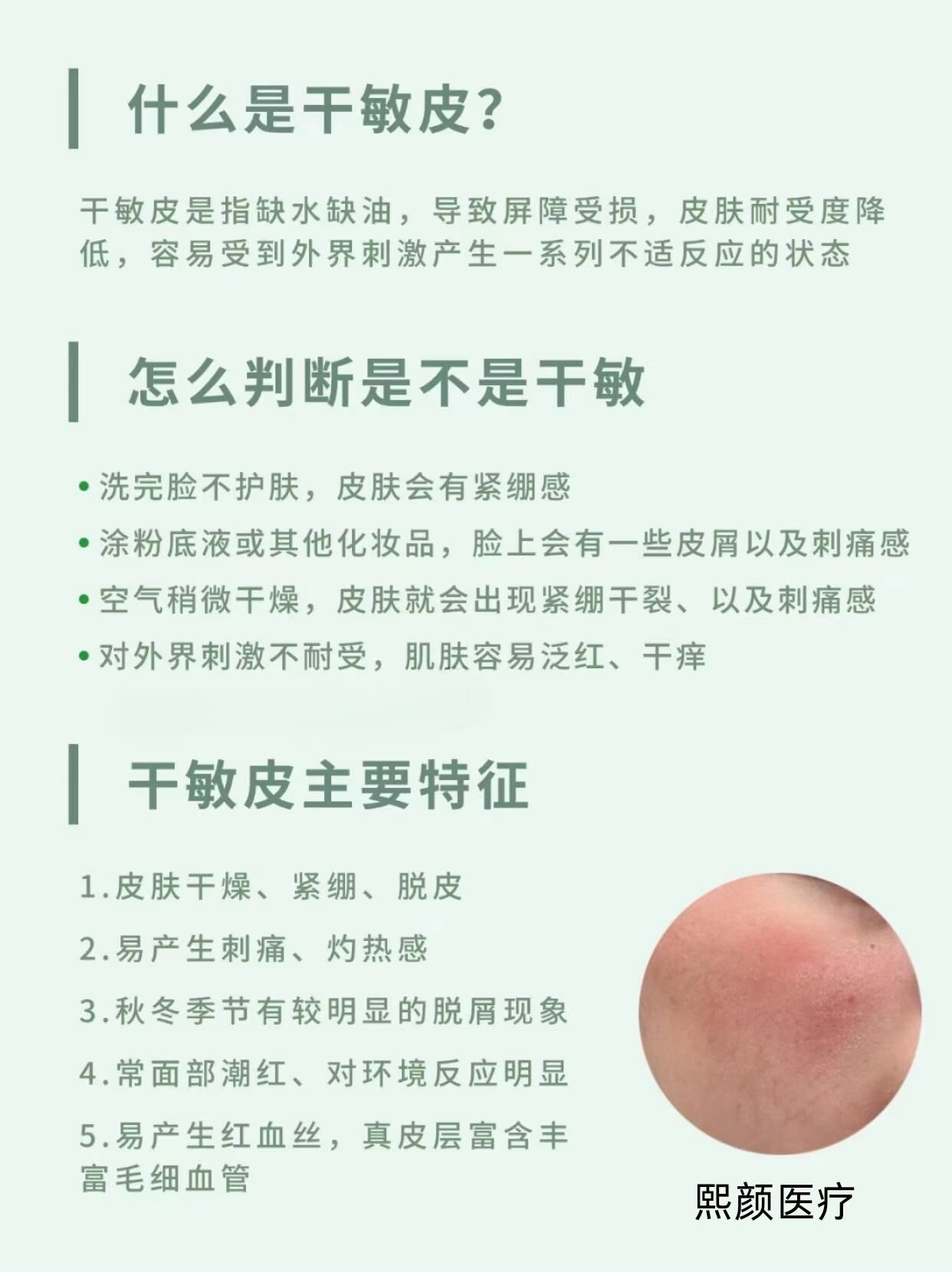 干敏皮特征图片