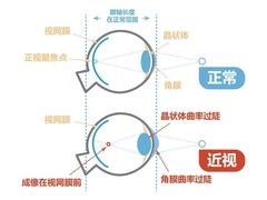 -宝视达眼镜(周口市广场店)