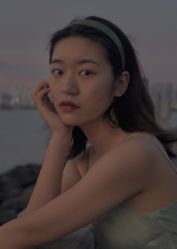 体验后-碧莲盛·不剃发植发