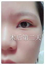 -八大处整形