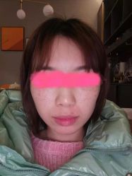 -大华韩艺整形美容医院