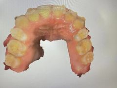 -同步齿科·数字化正畸种植口腔中心(珠海店)