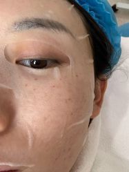 点击看大图 体验后-坤如玛丽·医疗美容中心