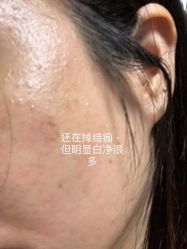 体验后-恒妍医美·韩国定制抗衰中心