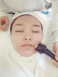 体验前-北京丽星翼美医疗美容