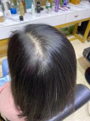 -髻尚坊增发补发织发假发定制