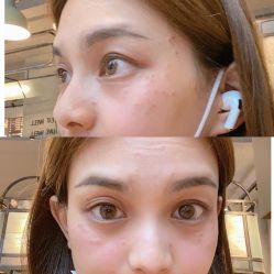-丽美妍医疗美容·皮秒·立体分层抗衰