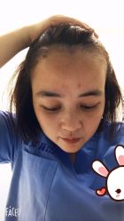 -大麦微针植发丨全国连锁