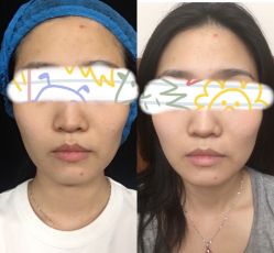 -广东韩妃整形外科医院