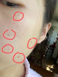 -成都军建医院·疤痕诊疗中心