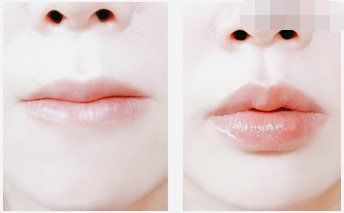 点击看大图 -SKINIST丽铂医疗美容