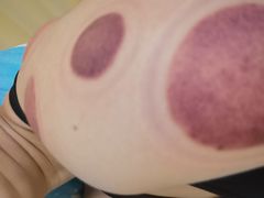 -浙江省立同德医院(翠苑院区)