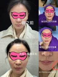 -美莱医学美容医院