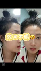 -雍禾植发全国连锁