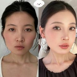 -Yestar 嘉兴艺星医疗美容医院