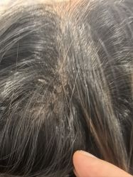 -熙朵美学植发·连锁品牌