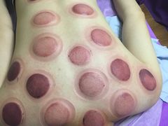-沈师傅盲人按摩工作室(密三小区店)