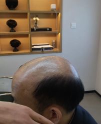 -极客侠男士假发定制补发