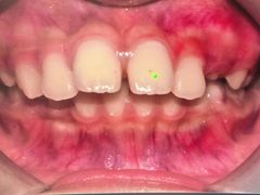 -金一口腔·舒适化正畸·儿牙中心