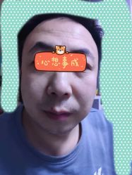 体验后-北京爱育华医院-医疗美容科