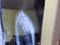 -张钰强中医正骨推拿连锁(华发商都店)
