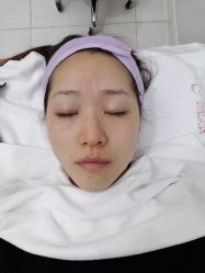-清颜专业祛痘连锁店