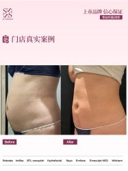 点击看大图 -Fundi张玉珊修身堂·indiba·BTL科技瘦身