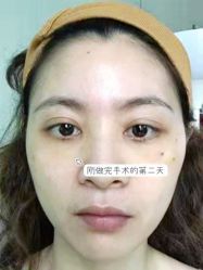 -天津健丽·去眼袋医疗美容机构