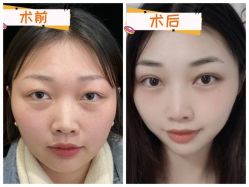 -素美医疗美容·西南眼鼻整形·修复基地
