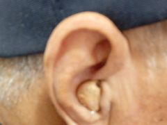 -安湃声助听器(密云店)