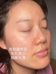 -Yestar艺星医疗美容医院
