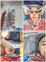 -More摩尔医美の注射线雕光电中心